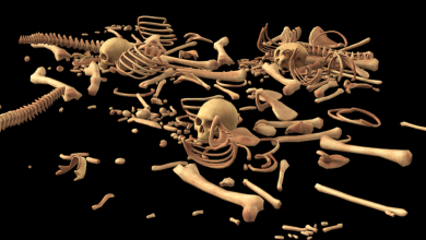 هشاشة العظام