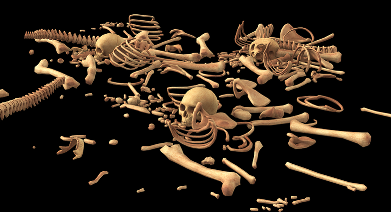 هشاشة العظام