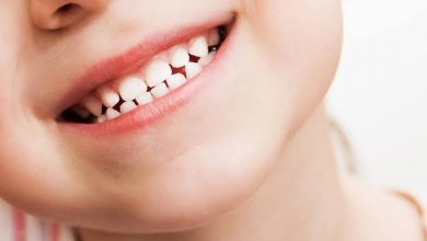 أسئلة شائعة حول تسوس الأسنان عند الأطفال | مشكلة تواجه كل أم !