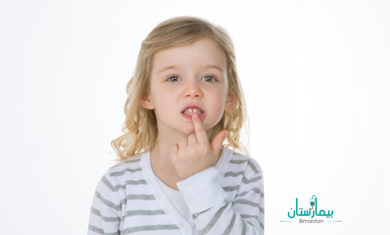تسوس الأسنان عند الأطفال | مشكلة تواجه كل أم !