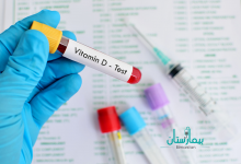 ماذا تعرف عن تحليل فيتامين د؟
