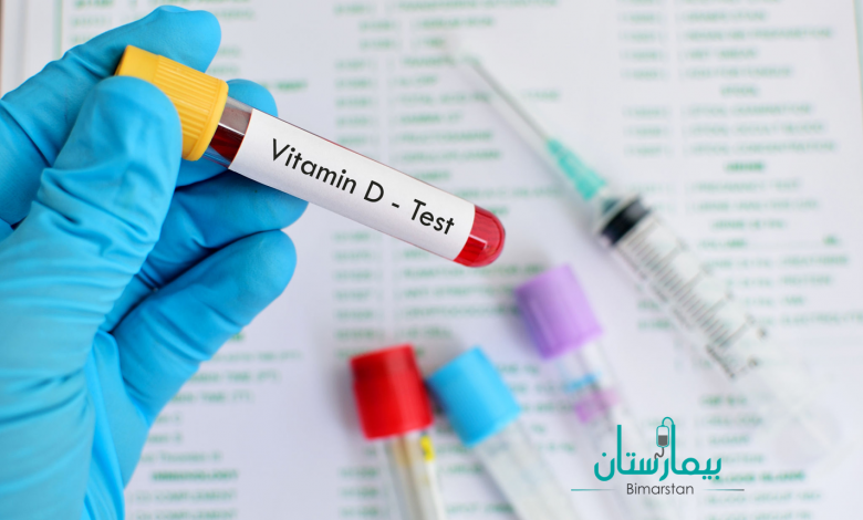 ماذا تعرف عن تحليل فيتامين د؟