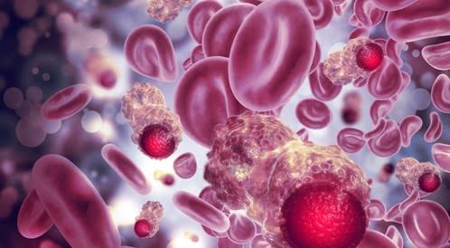 سرطان الدم عند الأطفال| هل يعد مرضًا خطيرًا؟