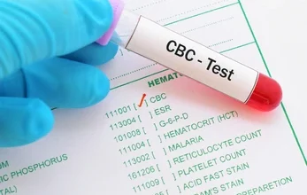 قراءة تحليل الدم cbc